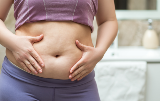 Tummy Tuck abdominoplasty Cosmetic Surgery Cyprus & Turkey