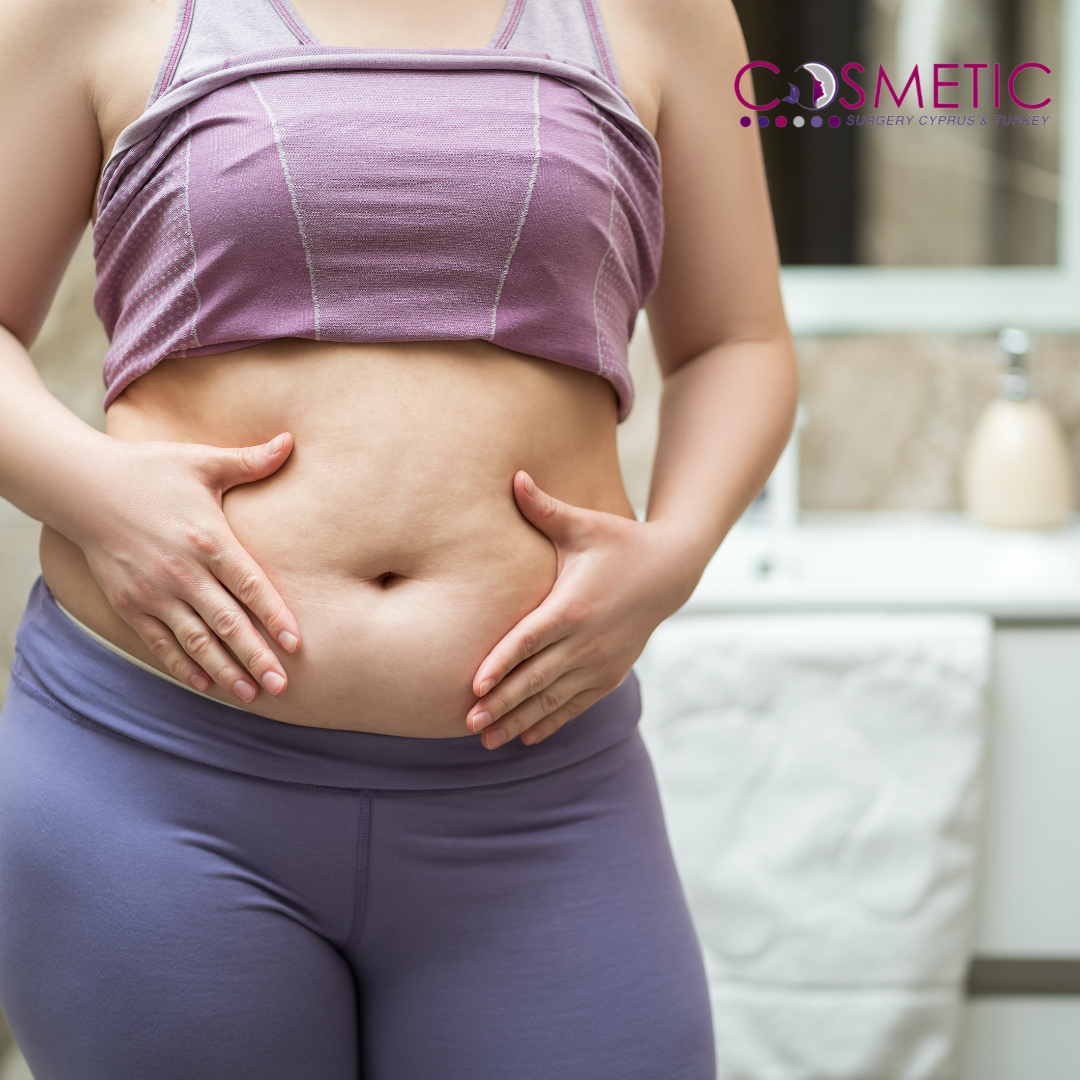Tummy Tuck abdominoplasty Cosmetic Surgery Cyprus & Turkey