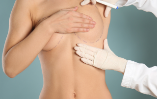 breast reduction and lift in cyprus and turkey