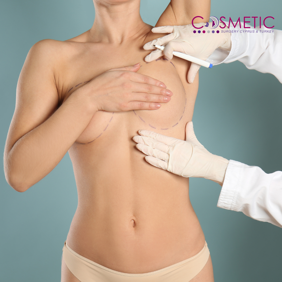 breast reduction and lift in cyprus and turkey